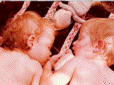 Helene et Alexis en 1978 